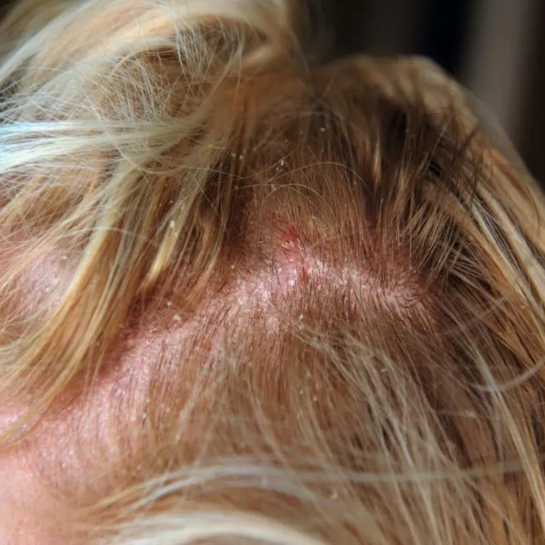 Untitled-design-10.png Untitled-design-10.png